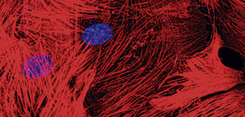 Confocal microscopy merged images of ACTA2 (red) immunostaining and DAPI-stained nuclei (blue) in a primary culture of vascular smooth muscle cells. (Juan Miguel Redondo)