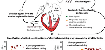 Methodology for monitoring and predicting atrial remodeling progression in patients with atrial fibrillation. (David Filgueiras)
                                                