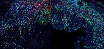 Cardiac macrophages in CX3CR1GFP/+ mice after myocardial infarction. Representative images of 30 μm maximum intensity projections of cardiac macrophages labeled with GFP (green), CD68 (red), and DAPI (blue) from CX3CR1GFP/+ mouse hearts isolated 3 (left) and 7 (right) days after injury. (Mercedes Ricote)
                                                
