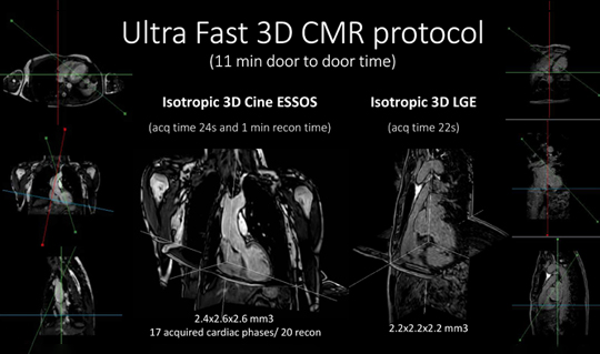 Ultra fast 3D CMR protocol