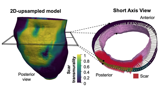 3D mapping of post-infarction scarring increases the prognostic potential of cardiac magnetic resonance imaging