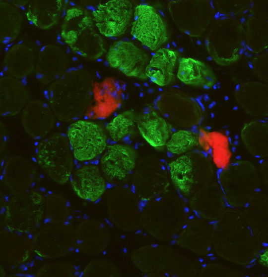 A rapid mechanism for muscle self-repair independent of stem cells