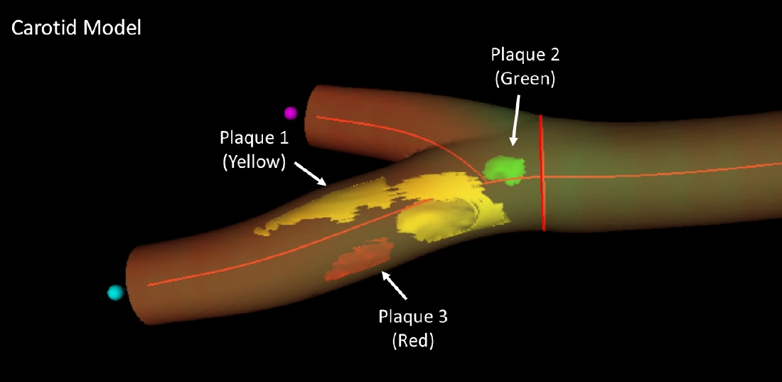 3D matrix ultrasound accurately identifies cardiovascular injury in healthy individuals