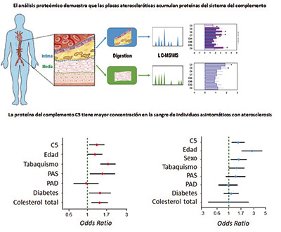 JACC. Spanish scientists identify a biomarker 
that detects atherosclerosis 
before the appearance of symptoms