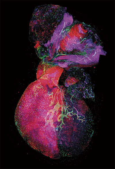 Development Cell. A CNIC-led international study discovers
a new origin of lymphatic vessels in the heart