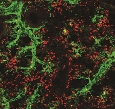 Cell. The unexpected repair function of neutrophils