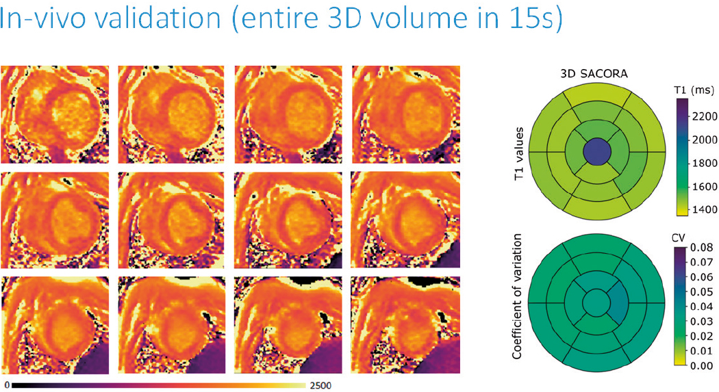 In-vivo validation