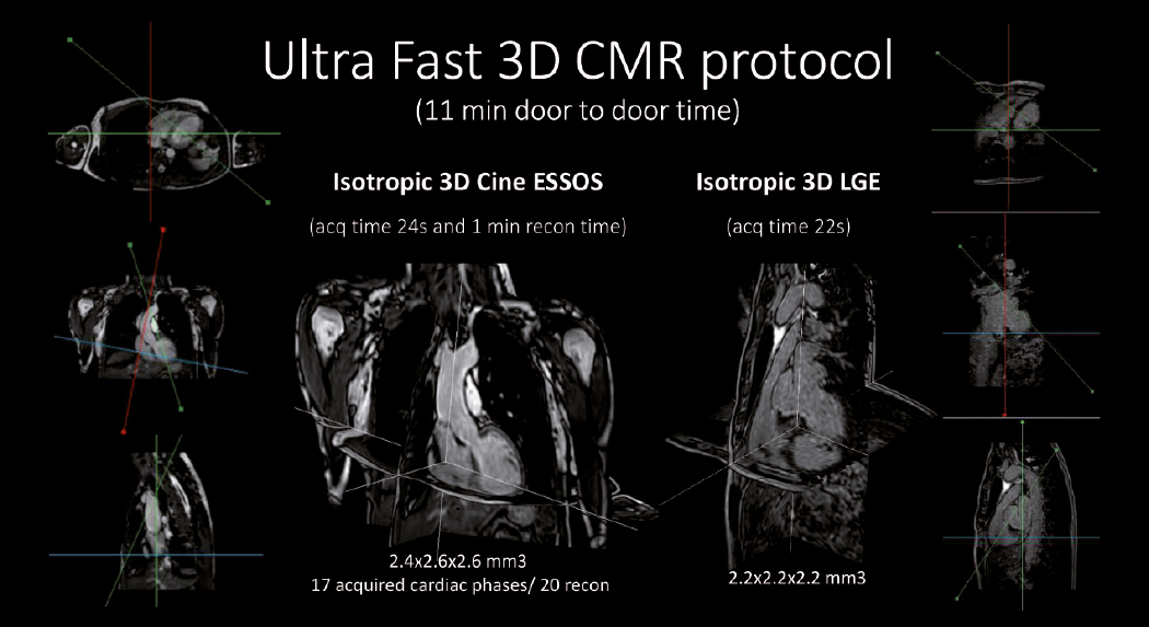 Ultra Fast 3D CMR protocol