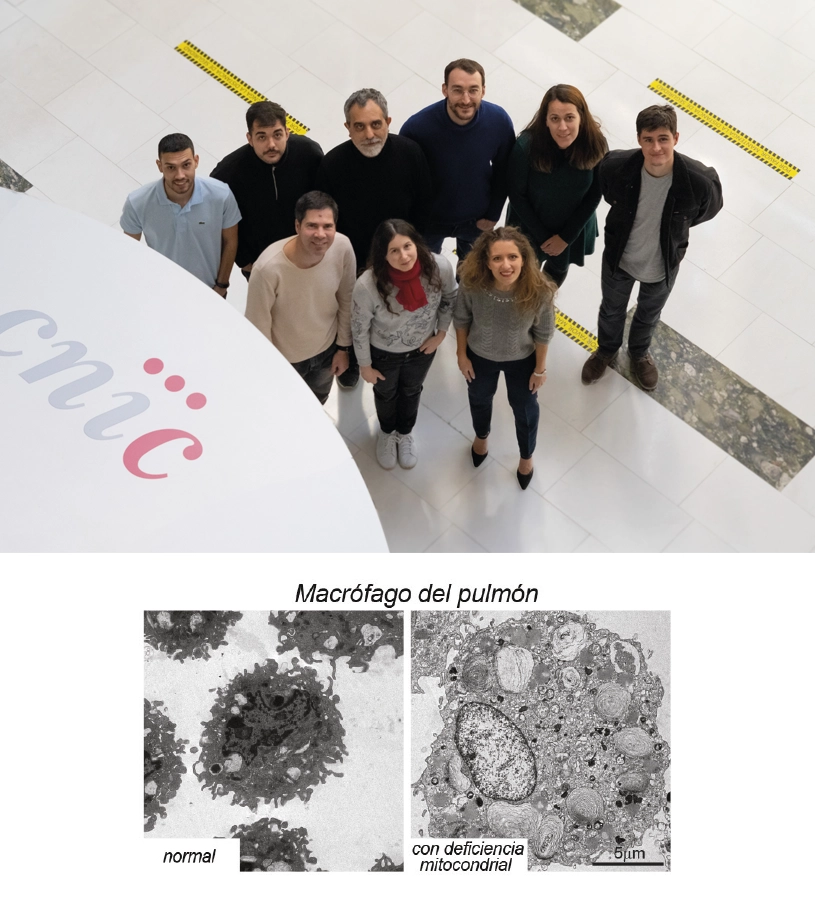 CNIC scientists identify a new therapeutic target in macrophages for the treatment of obesity-related diseases