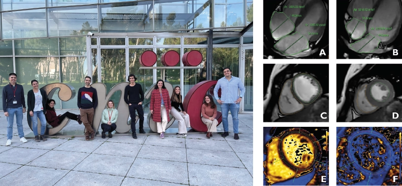 Imaging the adolescent heart
