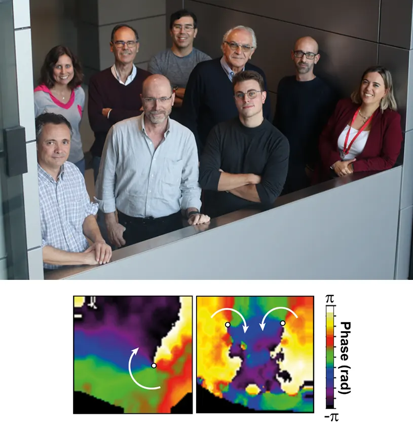 Spanish scientists discover a promising therapeutic target for cardiac arrhythmias