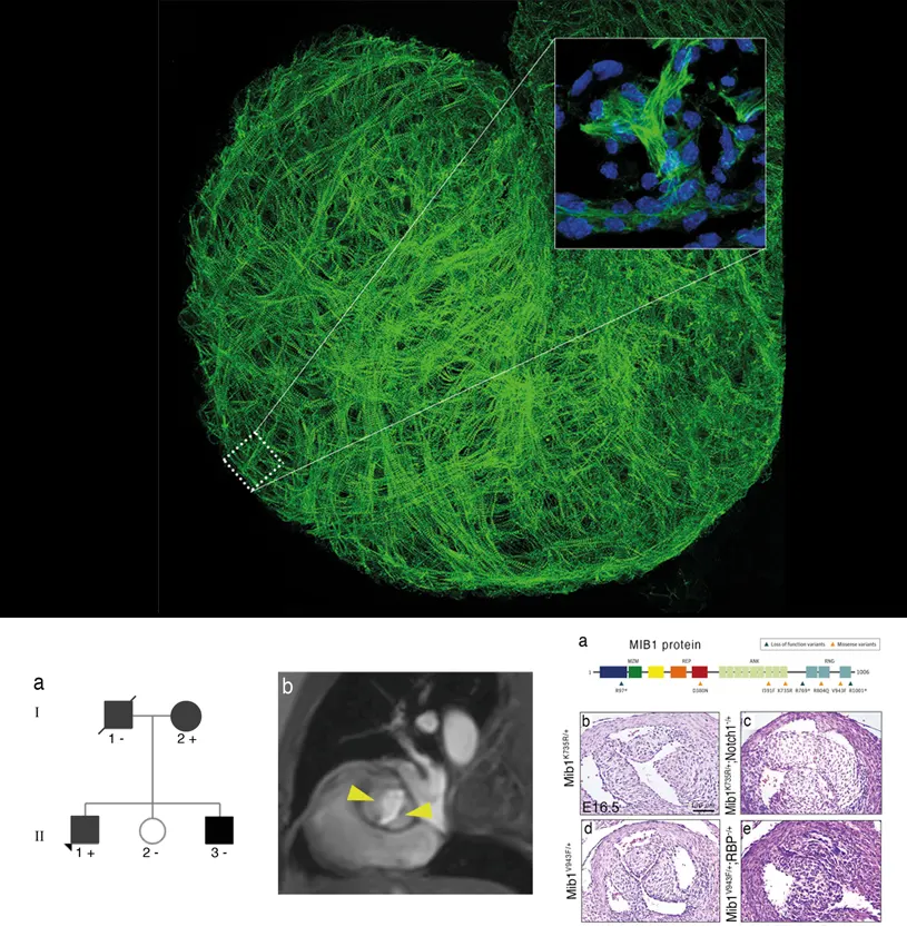 CNIC scientists identify the crucial role of the protein neuregulin-1 in heart development
