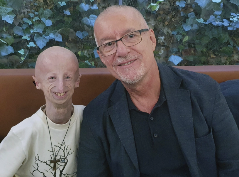 Sammy Basso, the Longest-Living Progeria Patient, Passes Away