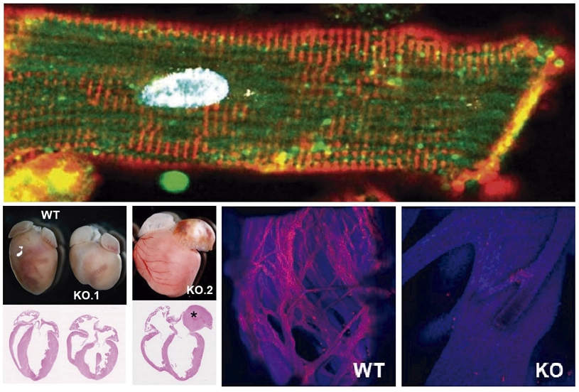 A key mechanism in the development and functioning of the conduction cardiac system is discovered