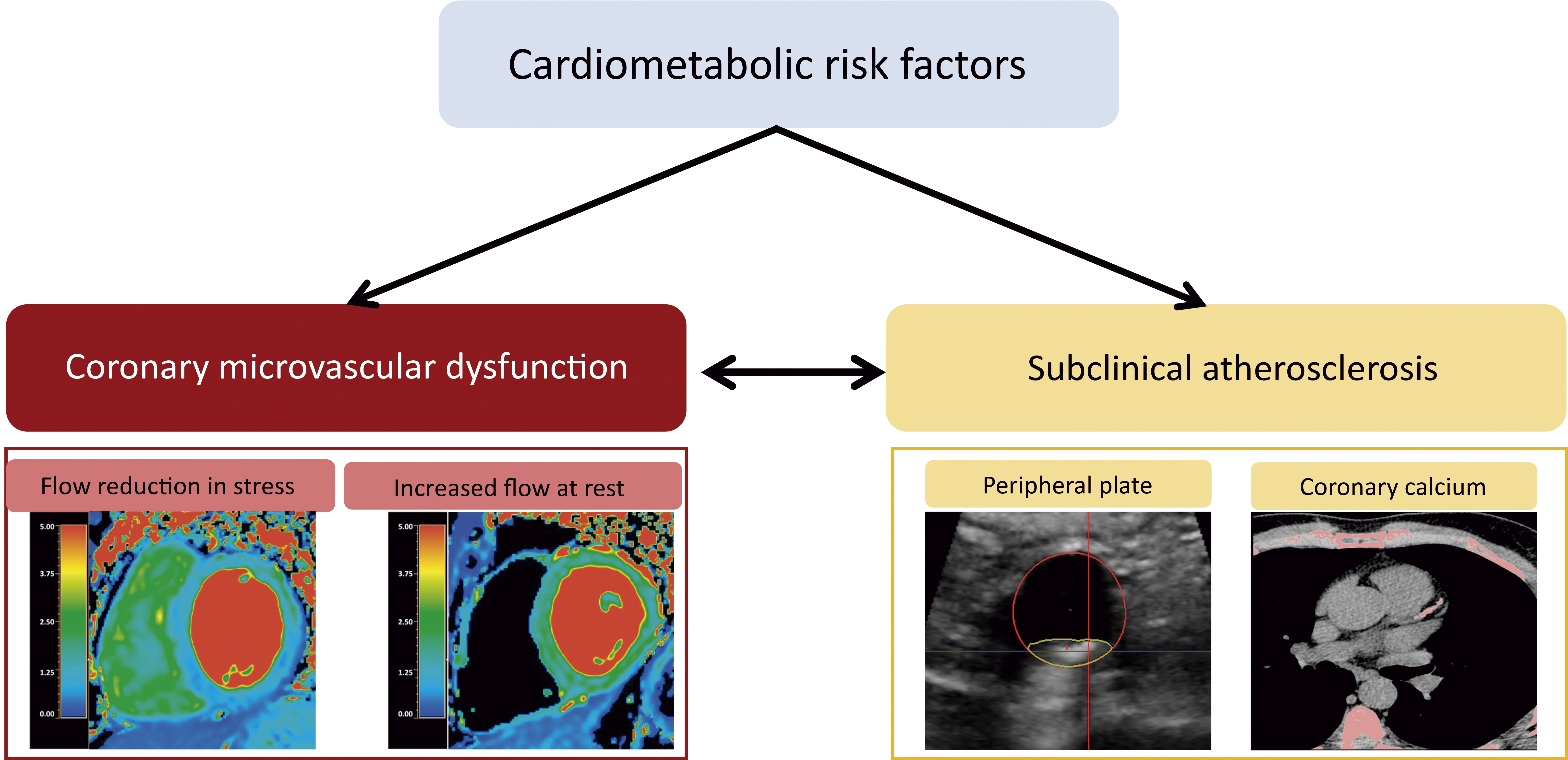 Cardiometabolic risk factors in apparently healthy individuals are linked to altered coronary microcirculation