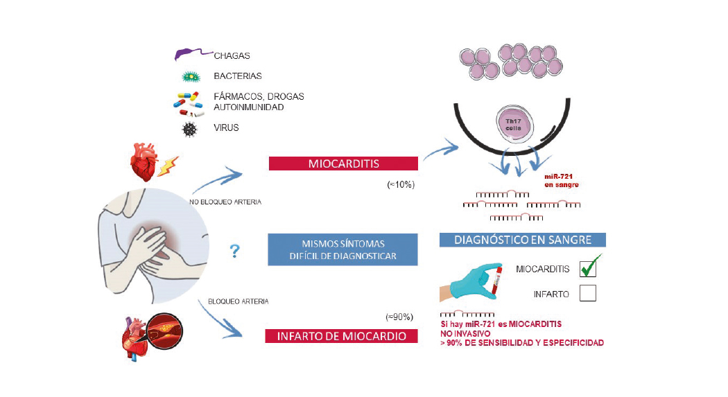Primer biomarcador en sangre que distingue la miocarditis de un infarto agudo de miocardio
