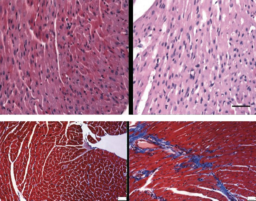 Descubren dos proteínas esenciales para el metabolismo del corazón de los recién nacidos