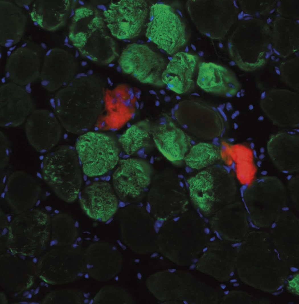 Un mecanismo rápido para la autorreparación muscular independiente de las células madre
