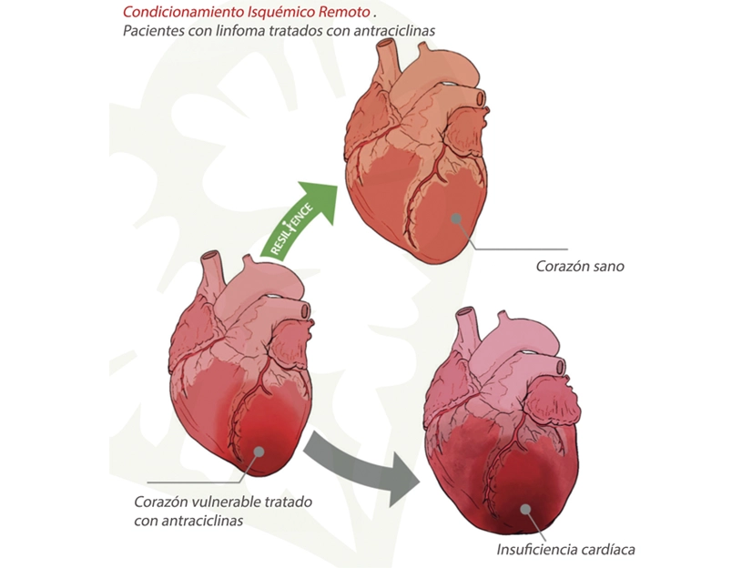 Prevenir el daño cardiaco causado por fármacos del cáncer: objetivo del proyecto RESILIENCE