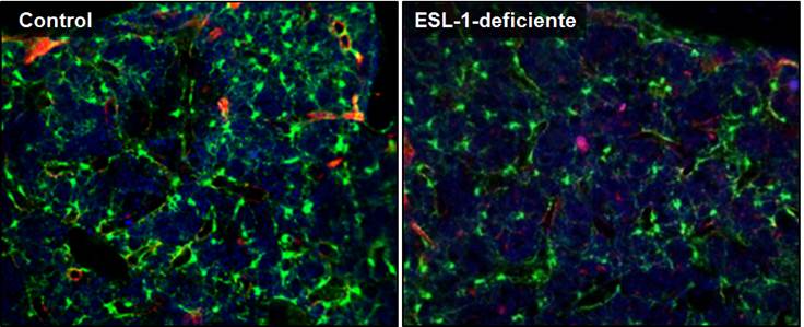 Figura 2. Imágenes de microscopia de fluorescencia de las médulas óseas de ratones reporteros para la citoquina de nicho CXCL12 trasplantados con médula ósea control (izquierda) o ESL-1-deficiente (derecha). El verde (señal GFP) identifica a las células productoras de CXCL12. 