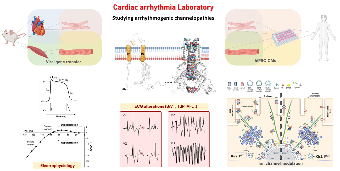 Arritmias Cardíacas