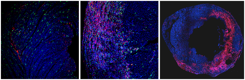 Our laboratory studies molecular mechanisms important in macrophage biology in a variety of physiological and pathological settings. The image shows cardiac macrophages (CD68 in red, CX3CR1 in green) in an uninjured heart (left) and at 3 (center) and 7 days post-injury (right).