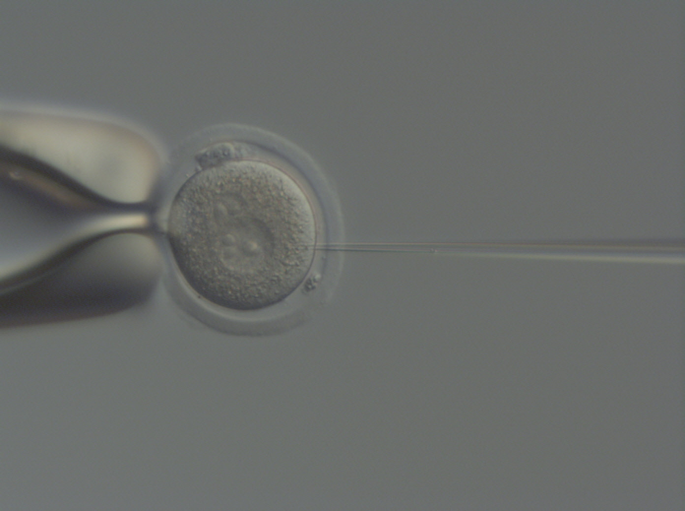 Image of a mouse zygote ready to be microinjected