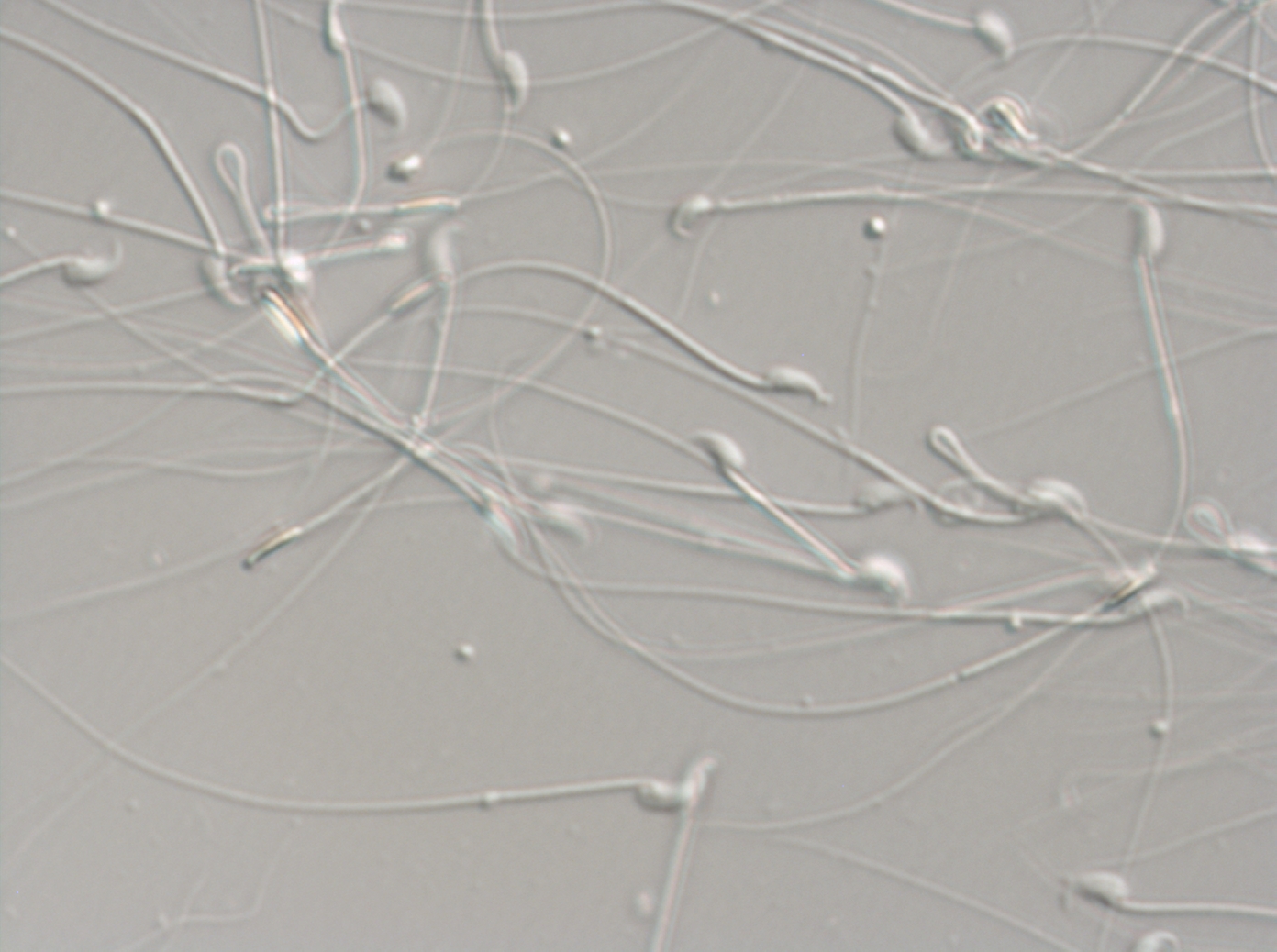 Detalle de espermatozoides de ratón