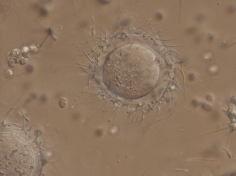 Ovocito de ratón en plena Fecundación In Vitro (FIV)