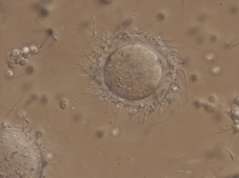 Mouse oocyte In Vitro Fertilization