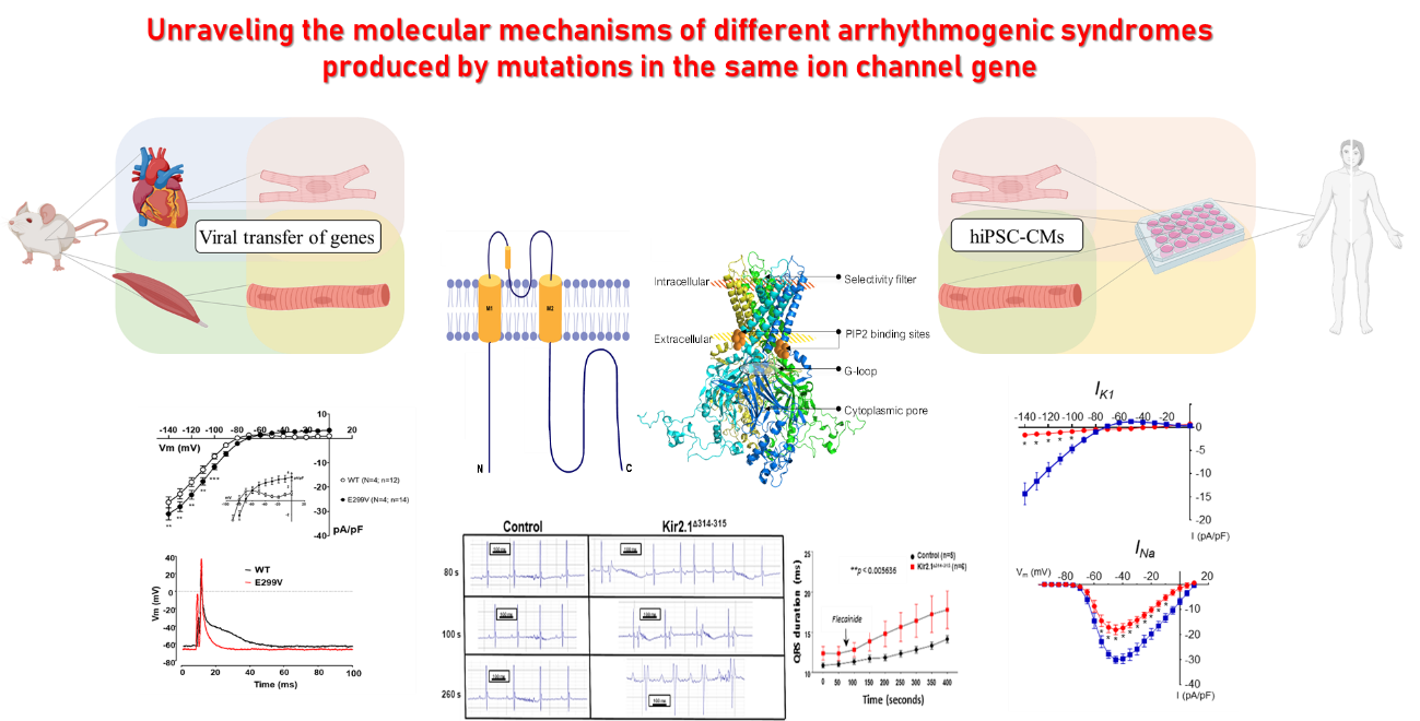 Unraveling the molecular mechanisms of different arrhythmogenic syndromes produced by mutations in the same ion channel gene