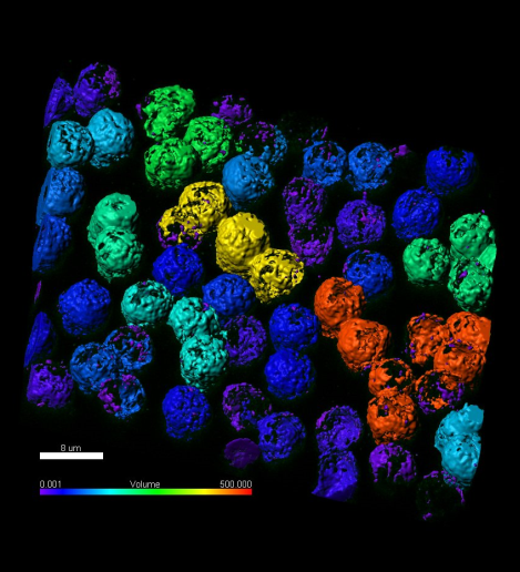 Proteína endógena HS1 en células B humanas  conseguida con Nanoscopía 3D-STED