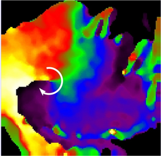 A rotor organizing atrial fibrillation in a sheep heart