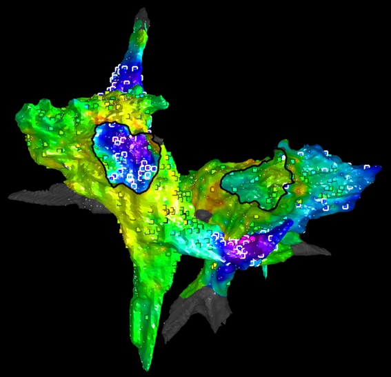 Mapa electroanatómico de las aurículas de un cerdo con FA persistente. Las regiones de color magenta, morado y azul oscuro presentan valores promedio altos de FM. Dichas regiones mantienen la FA y su ablación con catéter termina la arritmia. Los cuadrados representan la huella de la actividad rotacional, que es sensible pero no específica de las regiones que mantienen jerárquicamente la fibrilación.