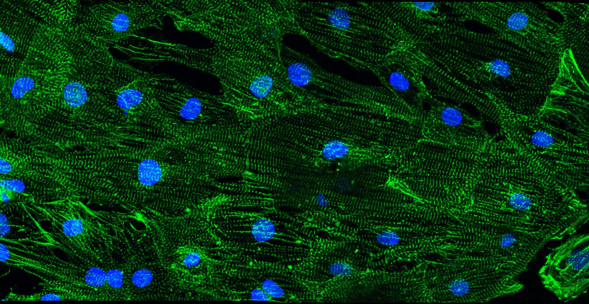 Microfotografía de una monocapa de cardiomiocitos derivados de células madre inducidas a la pluripotencia, representativa de las que se usaron para estudiar los mecanismos de arritmias y el rescate de la función normal por el gen que codifica a la sintrofina-α