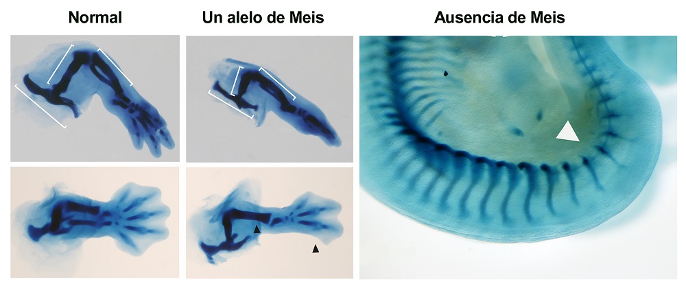 Skeletal staining of the inferior limb regions of normal embryos, embryos with a single Meis allele, and an embryo with complete absence of Meis. Embryos with a single copy of Meis lack the fibula and posterior digits (black arrow). Total absence of Meis prevents limb development (white arrow).