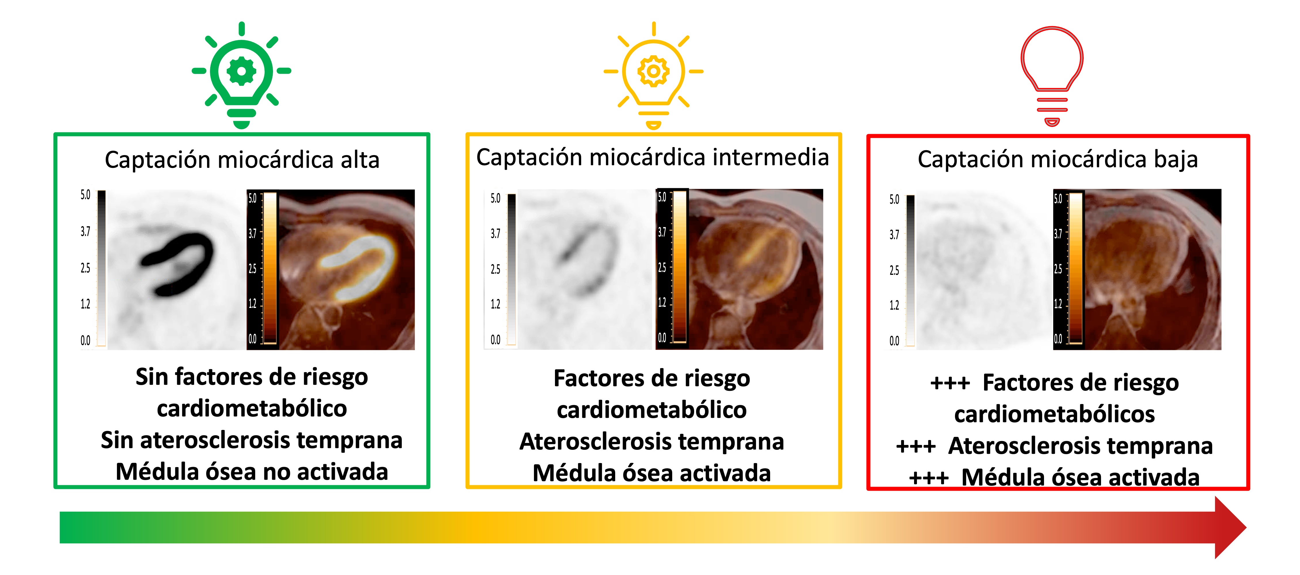 Los factores de riesgo cardiometabólico y la aterosclerosis temprana se asocian a un menor consumo de glucosa por el corazón