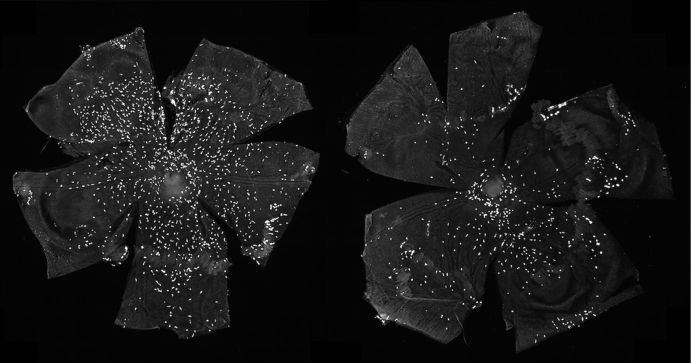 Imágenes de las coroides de ratones control (izquierda) y tras la eliminación de IHH de las células endoteliales (derecha), lo que resulta en una disminución del número de mastocitos (puntos blancos).