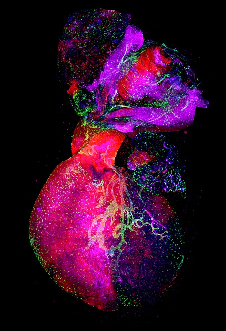 Se muestra el corazón y tejidos anejos con la visualización de los vasos linfáticos y las células descendientes del segundo campo cardíaco en rojo.