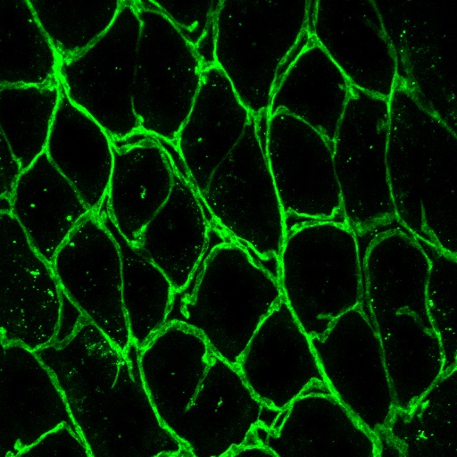 : Blood vessel duplications in the inflamed intestinal mucosa of a mouse with colitis.