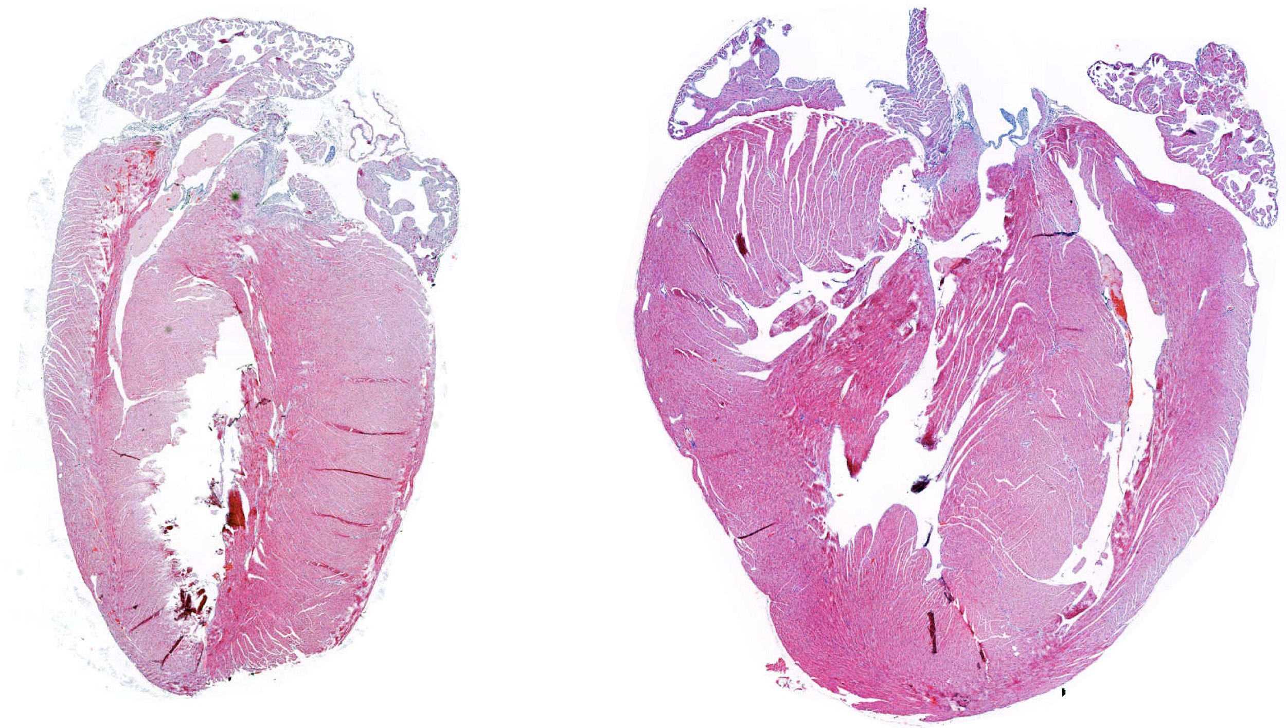 Imagen de histología que muestra la comparación del tamaño del corazón de un ratón normal (izquierda) y un ratón deficiente para la proteína MKK6 (derecha). 