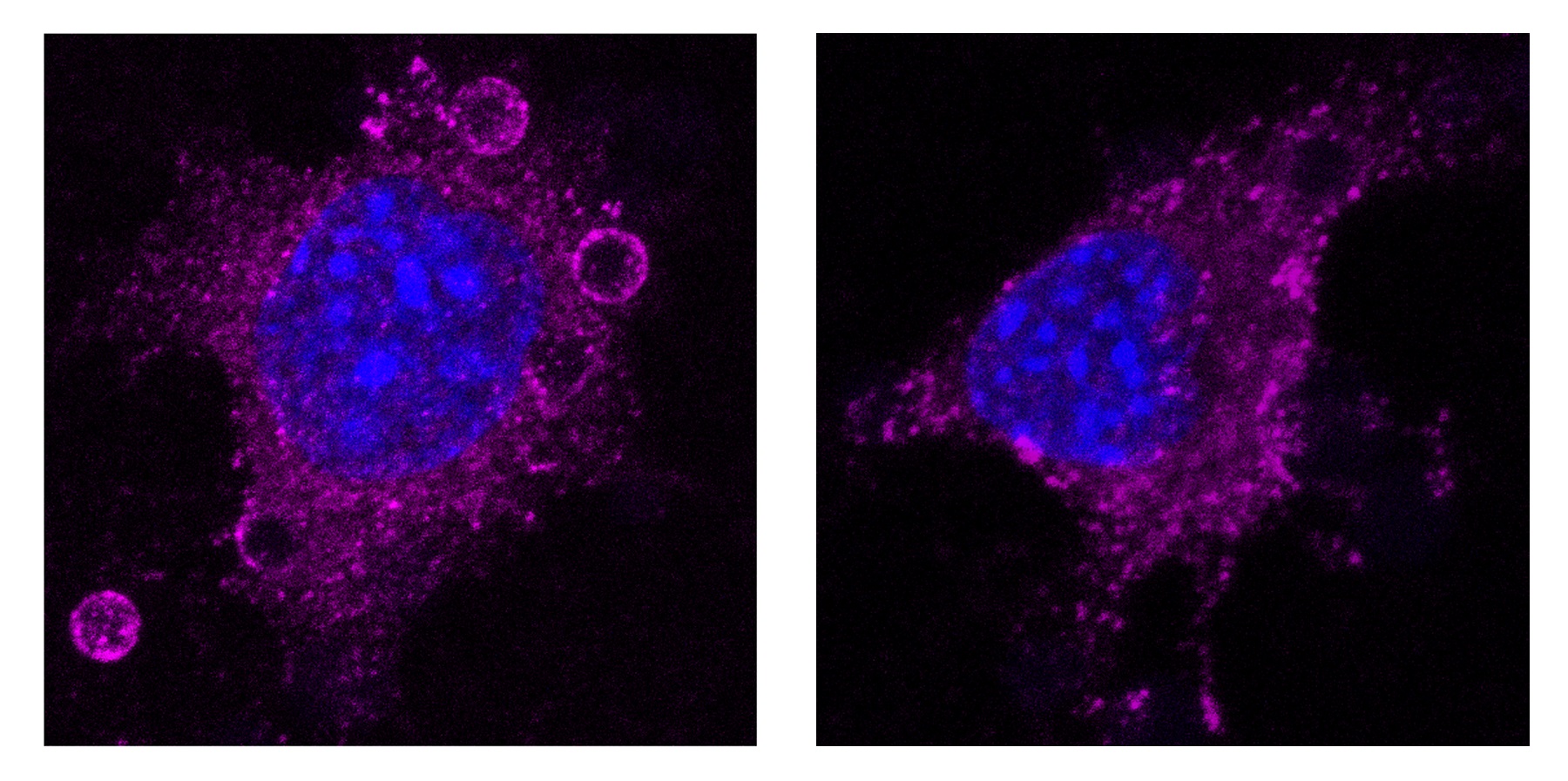 Fibroblasto embrionario murino Cav1KO (izquierda, sin caveolas) muestra un mayor reclutamiento de integrina beta 1 activa (magenta) en torno a bolitas recubiertas con fibronectina, en comparación con un fibroblasto embrionario murino Cav1WT (derecha, con caveolas).