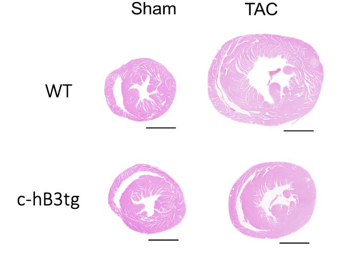 Transverse heart sections from wild type mice (WT) and transgenic mice overexpressing beta-3 adrenergic receptor in cardiomyocytes (c-h3tg) after 3 months of aortic stenosis (transaortic constriction, TAC) or control (sham). Hypertrophy after TAC was less severe in the transgenic mice