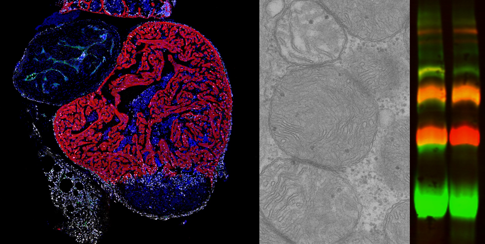 De izquierda a derecha: Immunofluorescencia en sección de corazón de pez cebra tras criolesion mostrando células proliferativas (blanco), cardiomiocitos (rojo) núcleos celulares (azul). Imagen de Microscopia electrónica mostrando mitocondrias. Gel Blue Native mostrando bandas correspondientes a supercomplejos formados por CIII (rojo) y CIV (verde).