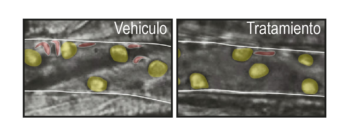 Protection against blood vessel occlusion in animals with sickle cell anemia after treatment with circadian clock inhibitors. Vessel walls are shown as white lines, neutrophils in yellow, and red blood cells trapped by neutrophils in red. 