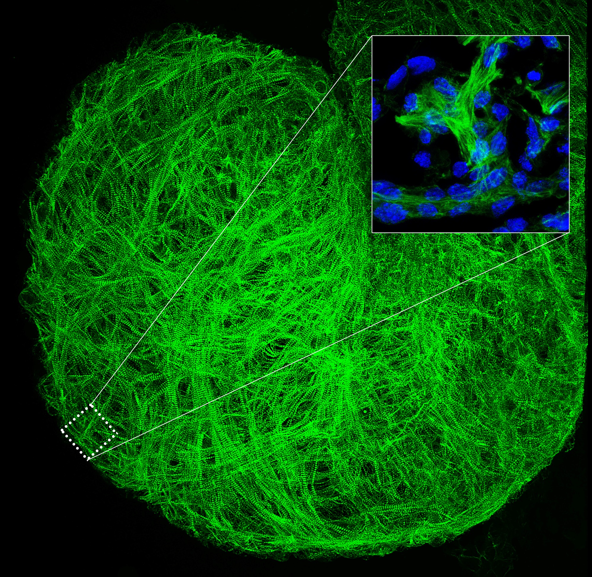 Neuregulin-1 induces changes in actin filaments during ventricular maturation. Actinin staining of a mouse embryo heart reveals a striated actin pattern corresponding to mature trabecular sarcomeres (green). The magnified view shows the differences in luminosity that distinguish the more organized actin filaments of the trabecular myocardium from the less organized compact layer