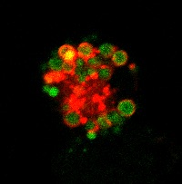 Microscopía confocal mostrando un macrófago peritoneal de un ratón deficiente en RXR, donde se observa un alto contenido de lípidos (verde) dentro de vesículas ácidas (rojo).