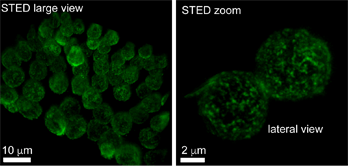Reconstrucción de una imagen 3D-gSTED de cortes de 4 µm en Z de leucocitos humanos con la proteina HS1 inmunoteñida.