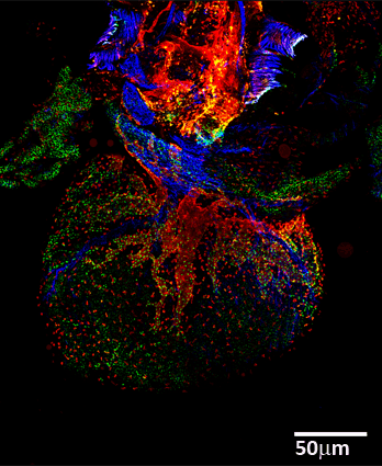 Tiled High Resolution Confocal Image of a cleared mouse embryonic heart. SMAcy3 (blue), Lyvel 633 (red) and Prox1 cy5.5 (green).