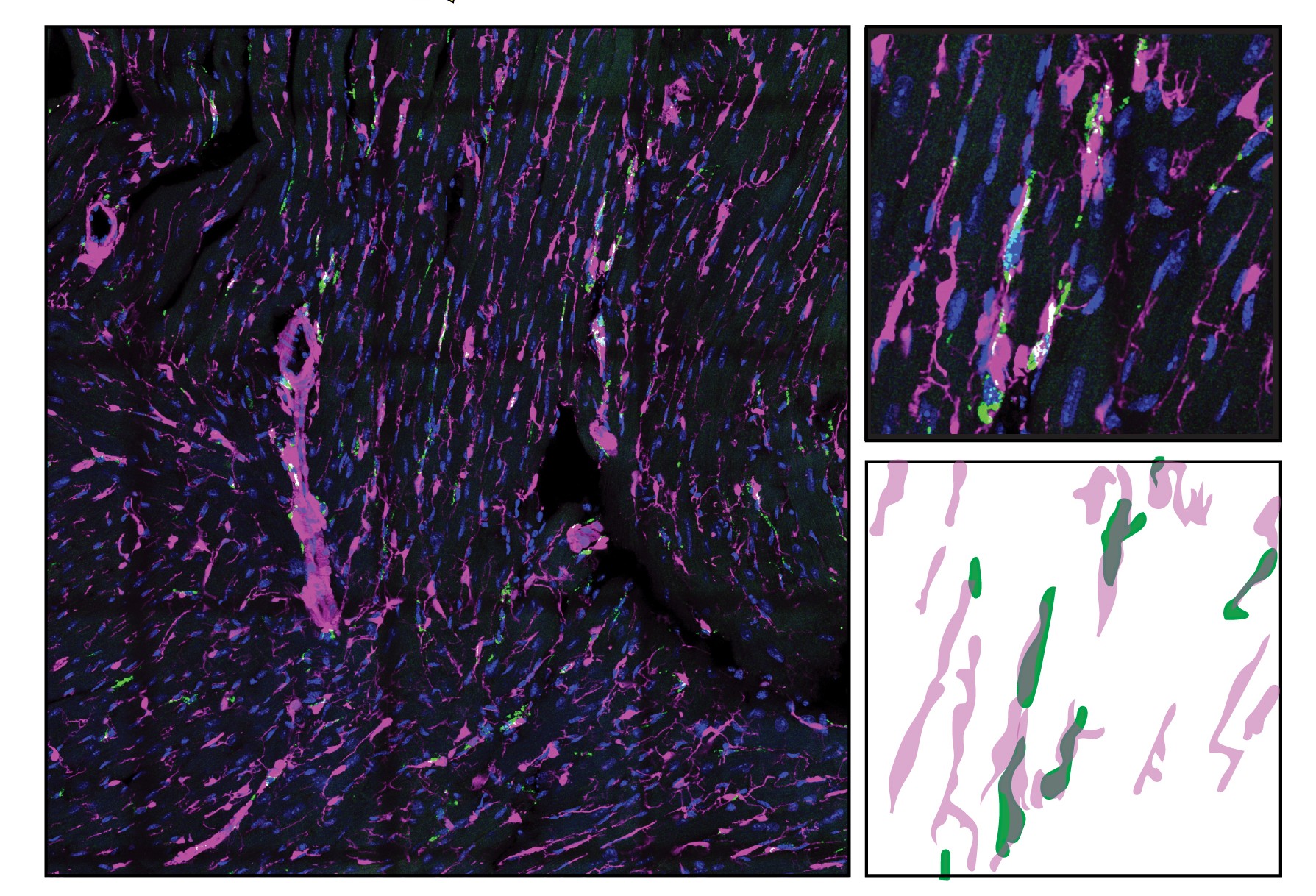 Images show macrophages (green) in close association with fibroblasts (magenta).